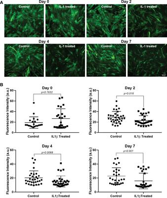 Effects of Proinflammatory Cytokines on Lacrimal Gland Myoepithelial Cells Contraction